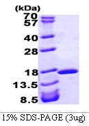 Human Fatty Acid-Binding Protein 2 (FABP2)