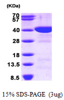 Human FBP1
