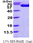 Human Fascin