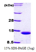 Human Fatty Acid-Binding Protein 1 (FABP1)