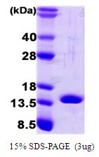 Human Fatty Acid-Binding Protein 4 (FABP4)