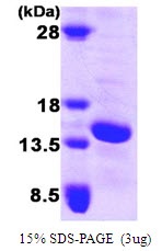 Human Fatty Acid-Binding Protein 5 (FABP5)