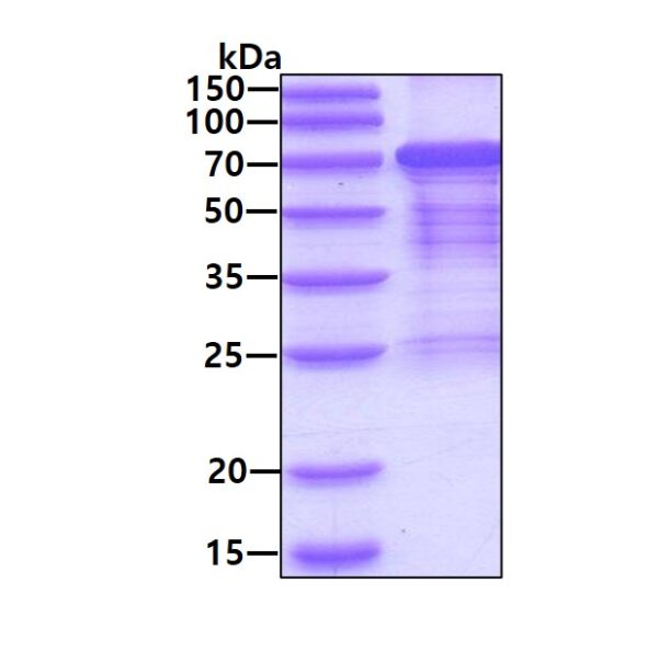 Human Heat Shock Factor Protein 1 (HSF 1)