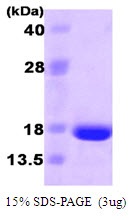 Human Fibroblast Growth Factor 2 (FGF-2)