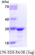 Human Fibroblast Growth Factor 21 (FGF-21)