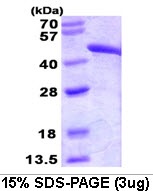 Human Fumarate Hydratase