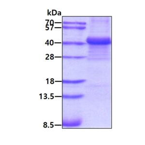 Human FGB (Fibrinogen beta Chain)