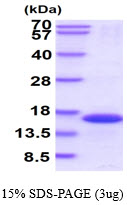 Human FKBP1B
