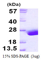 Human Fatty Acid-Binding Protein 9 (FABP9)