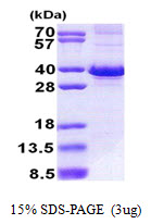 Human FBXO6