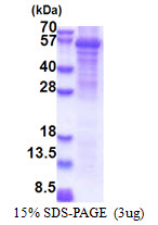 Human Fatty-Acid Amide Hydrolase 2 (FAAH2)