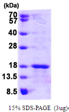 Human Glutaredoxin 5