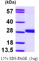 Human GSTM4