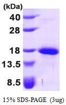Human Growth Differentiation Factor 5 (GDF-5)