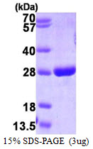 Human GSTP1