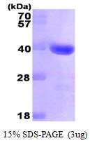 Human Galectin-4  (Gal-4)
