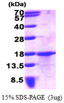 Human GDF-15