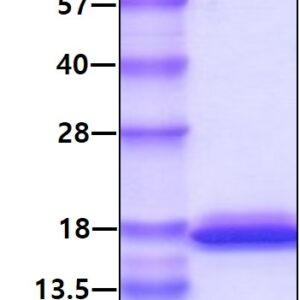Human Glutaredoxin-2