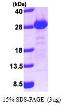 Human Golgi-associated PDZ and Coiled-coil Motif-containing Protein (GOPC)