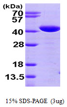 Human Glutaredoxin-3