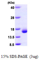 Human Galectin 2