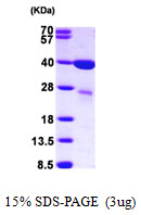 Human Galectin 8