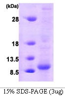 Human Glutaredoxin-1 (GLRX)