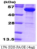 E.coli Glucose-6-Phosphate 1-Dehydrogenase (G6PD)
