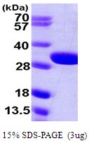 E.coli Glutaminase 1 (glsA1)