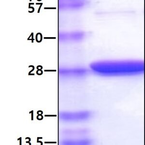 Human Glutathione Peroxidase 1 (GPX1)
