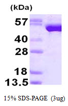 Human Glutathione Reductase