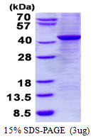 Human G protein alpha Z