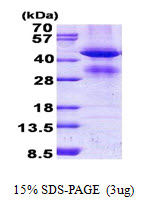 Human Glycine Acetyltransferase (GCAT)