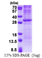 Human Granzyme K (GZMK)
