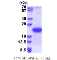 Human GTSF1