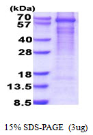 Human Glutamate Decarboxylase 1 (GAD1)