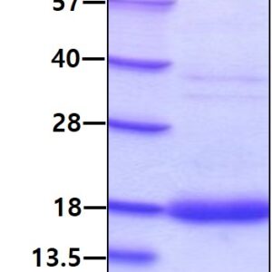 Human G-CSF