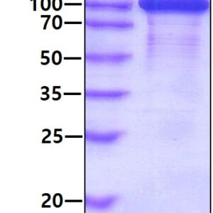 Human HSP90B1