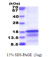 HCV Core protein