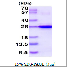 Human Heat Shock Protein beta-8 (HSPB8)