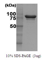 Human Heat Shock Protein 90 (HSP90)