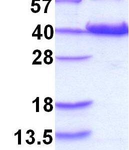 Human HIF-1 alpha