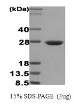 Human Heat Shock Protein 27 (HSP27)