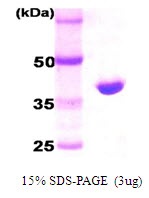 Human High Temperature Requirement Protein A2 (HtrA2/Omi)
