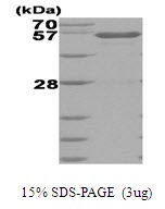 Human Glucokinase (Hexokinase-4)