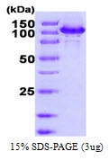 Human Heat Shock Protein 105a (HSP105a)
