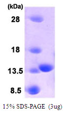 Human HRASLS3