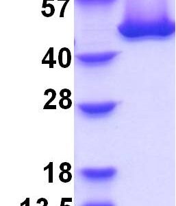 Human Heat Shock Protein 47 (HSP47)