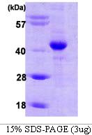 Human HIF1AN