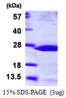 Human Heat Shock Protein beta-2 (HSPB2)
